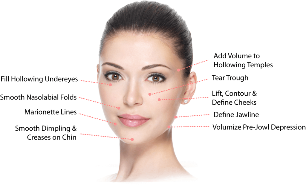 Sculptra ABM Medical