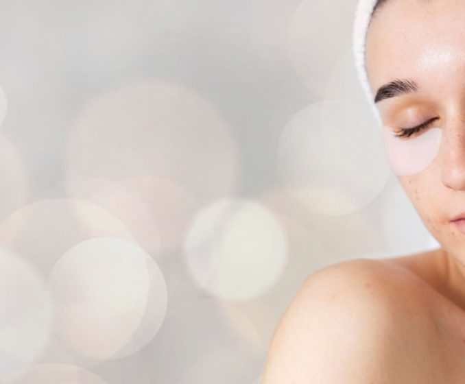 acne-scar-abm-medical